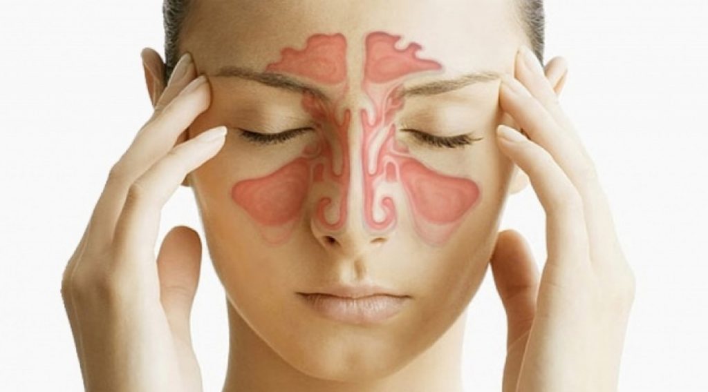 Deviaţia de sept nazal: diagnostic, tratament